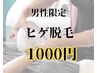 【男性限定】ヒゲ脱毛全体　1000円