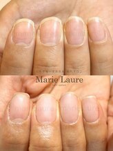 マリーロール 淀屋橋本店(Marie Laure)/自爪育成/深爪矯正/ネイルケア