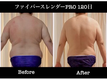 未来型スパエステ サリスパ(SARI SPA)/メンズビフォーアフター