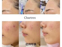 シャルトルズ/《症例写真》諦める前に