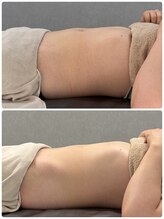 ティエルプラス(tiele+)/骨盤調整×HOT腸もみ