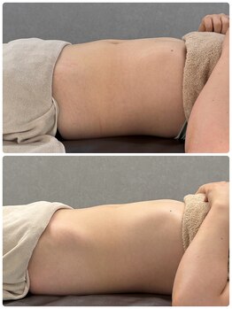 ティエルプラス(tiele+)/骨盤調整×HOT腸もみ