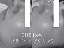 ザ フロウ(THE flow)/開き毛穴をプラズマでケア