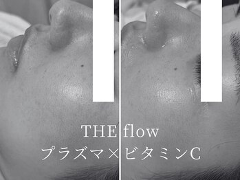 ザ フロウ(THE flow)/開き毛穴をプラズマでケア