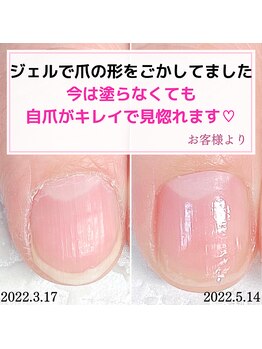 ミミ(mimi)/自爪がキレイで見惚れます！