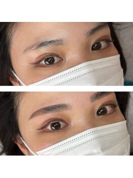 バンビッシュ 吉祥寺店/HBL&マツパ同時施術(増田)