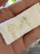 リンカ(Rinca)/毛穴エクストラクション尾張旭市