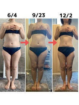 ハレアンド(Hare&)/40代全身痩身6ヶ月Before After