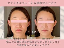 ソルビーフェイス(SOL*BeFace)の雰囲気（ブライダルフォトから結婚式へ☆セルフケアも頑張り理想の小顔へ）