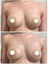 ルナグランデ 心斎橋店(Luna grande.)/全体的ボリュームUP