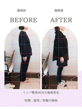 ヨギート(yogate)/リンパ/骨盤矯正/ヘッドスパ小顔