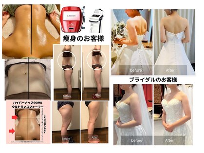 エリセオ(eliseo)の写真