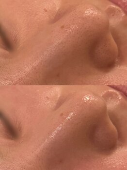 セレニテ(Serenite)/