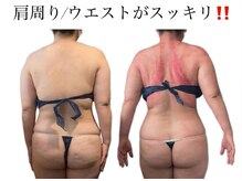 痩身革命 大宮店/ダイエットリンパマッサージ