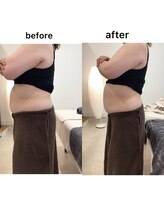 ジョワイユ(Joyeux)/腸の位置でお腹は変わる