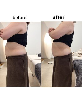 ジョワイユ(Joyeux)/腸の位置でお腹は変わる