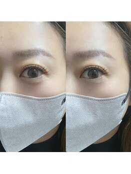 タイド バイ ホープ(tied by Hope)/【Wフラット120本】