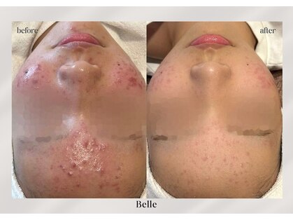 ベル 水戸(Belle)の写真