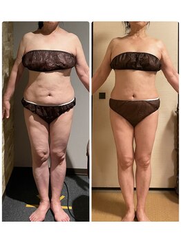 サンタイ(santai.)/姫路で唯一の次世代筋膜エステ