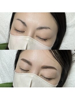 テテ(TeTe)/ハリウッドブロウリフト