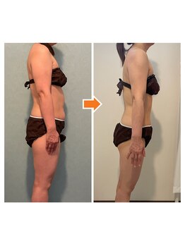 サルサナ(Salu Sana)/痩身！LサイズのズボンもSサイズ