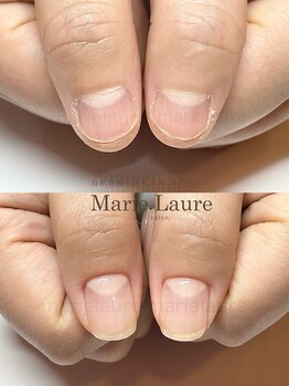 マリーロール 淀屋橋本店(Marie Laure)/自爪育成/深爪矯正/ネイルケア