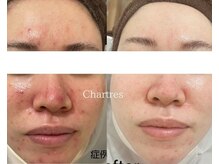 シャルトルズ/《症例写真》