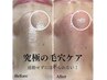 【リピータ続出!】黒ずみ撃退!毛穴エクストラクション ¥4500
