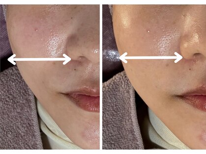 エルナ(ELUNA)の写真