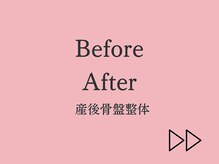 アオラド(Aolado)/産後骨盤整体