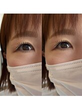 タイド バイ ホープ(tied by Hope)/【Ｗフラット80本】