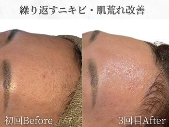 芯美 恵比寿店(shinbi)/クリスティーナ/ビオフィート