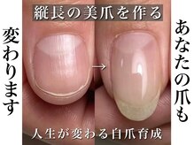 リリー