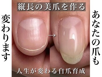 リリーの写真/深爪・噛むクセ、爪の形を綺麗にしたいなど爪のお悩みを解消するサロン◆丁寧なケアで自信が持てる手元へ♪