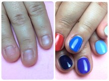 マニエネイル(mani e nail)/深爪/深爪矯正/自爪育成/ケア