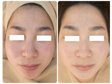 クレイルサロン(Claire salon)/