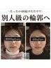 【ご新規様限定】小顔頭蓋骨矯正＋リンパケア4回¥30800→¥22800吉岡店限定