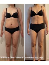 リリィ(RIRY)/【痩身ビフォーアフター】