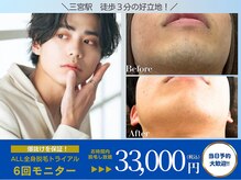 メンズビオ 神戸三宮店の雰囲気（何よりも脱毛効果を重視するあなたに！爆抜け特化型でヒゲ撲滅！）