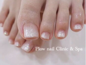 プラウネイル(Plow Nail)/【Foot】ラメグラデーション