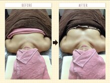 エステティックサロン ピュール ボーテ 東金店/バストコース