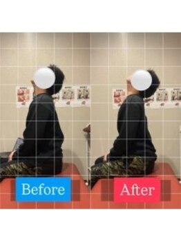 ナオル整体 宮崎院(NAORU整体)/20代男性施術事例【肩こり改善】