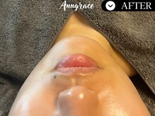 アングレイス(Anngrace)/