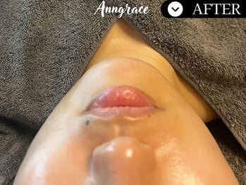 アングレイス(Anngrace)/