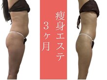ムーン(MOON)/無理なく続けて、理想の身体へ！