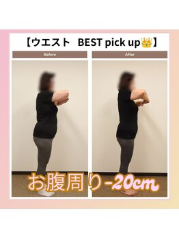 えのもと美容整体院/【痩身整体ダイエット】