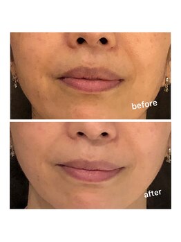 すっぴん美肌革命/ツヤと透明感で印象パッとUP