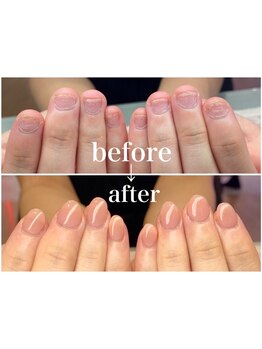 爪の悩みを解消できる（ケア含む）