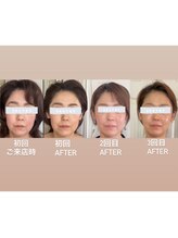 ブリリアント 西宮(Brilliant)/ひと月に一度のメンテでこの効果