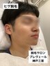 ☆ 痛みがほぼないヒゲ脱毛【あご・あご裏・頬・鼻下・首のうち１部位】初回